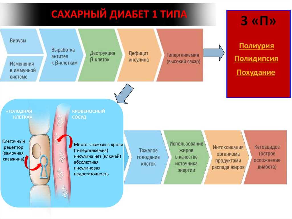 Сахарный диабет первого типа картинки