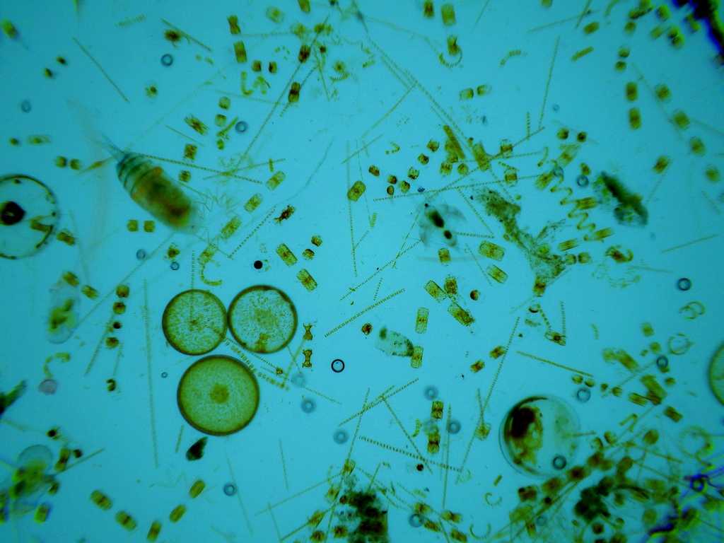Скопление живых организмов. Фитопланктон диатомовые водоросли. Планктонные водоросли фитопланктон. Одноклеточные планктонные водоросли. Фитопланктоны биоиндикаторы.