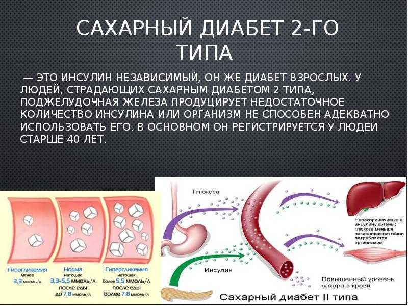 Картинки про сахарный диабет 2 типа